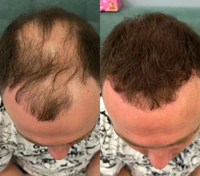 Instant Hair Density Concealer
