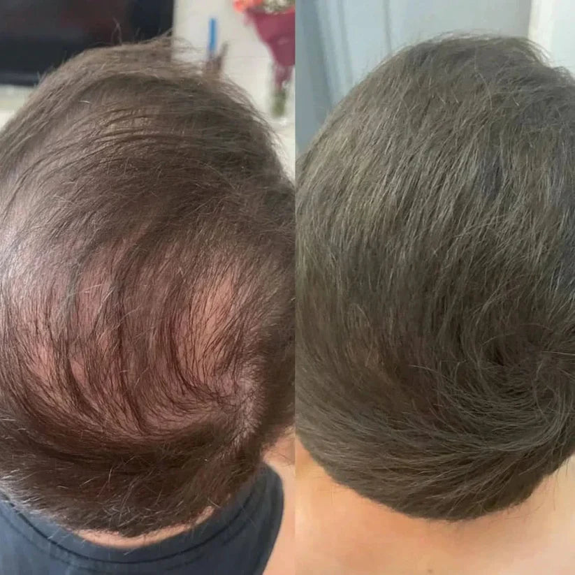 Instant Hair Density Concealer