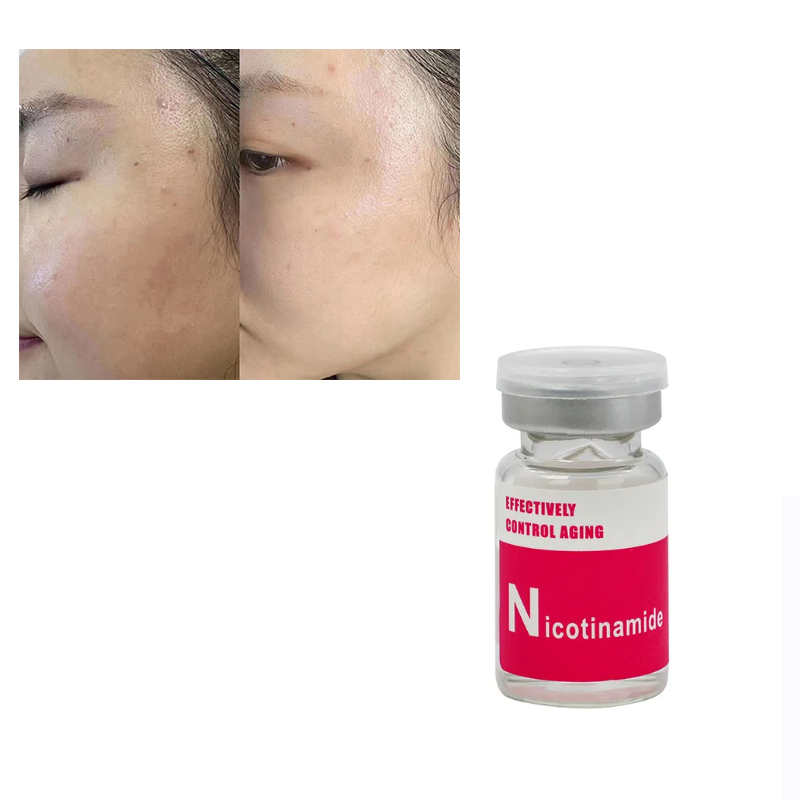 iRenice Nicotinamide Hyaluronic Non Cross Linked Mesotherapy Solution For Face Whitening dark spots, skin tone 5ml