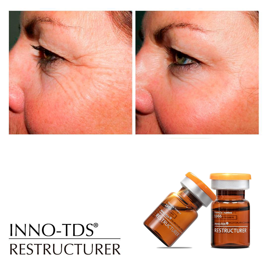 Prevents cell oxidation Anti-aging INNO-TDS RESTRUCTURER (4 X 5ML)-iRENICE