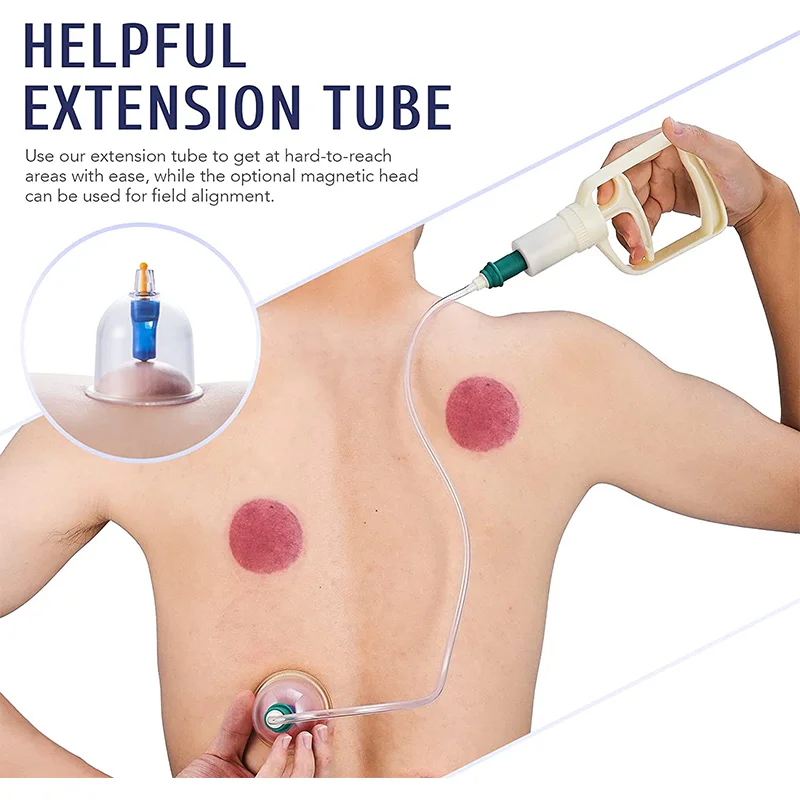 Vacuum Cupping Body Massager(50% OFF Last Day!!!)