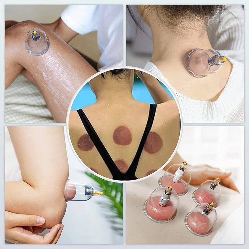 Vacuum Cupping Body Massager(50% OFF Last Day!!!)