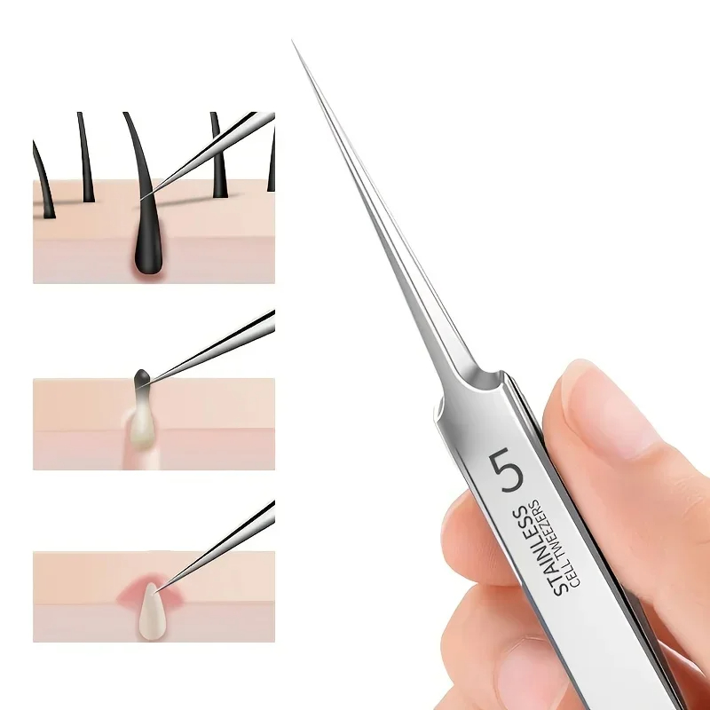 🔥Professional Facial Blackhead Remover Tweezers(50% OFF!!!)