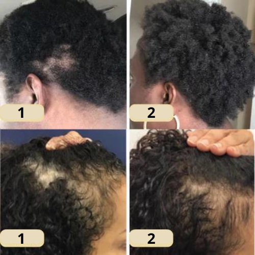 Natural Oil Hair Growth Essence