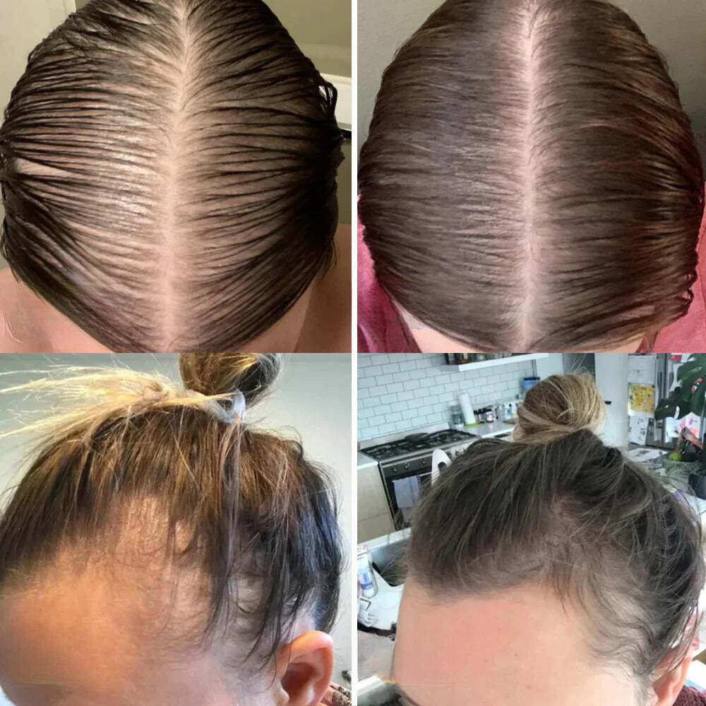 Natural Oil Hair Growth Essence