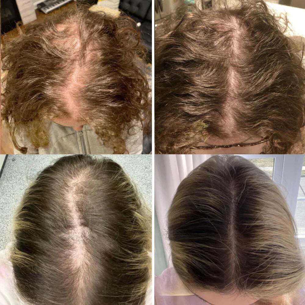 Natural Oil Hair Growth Essence