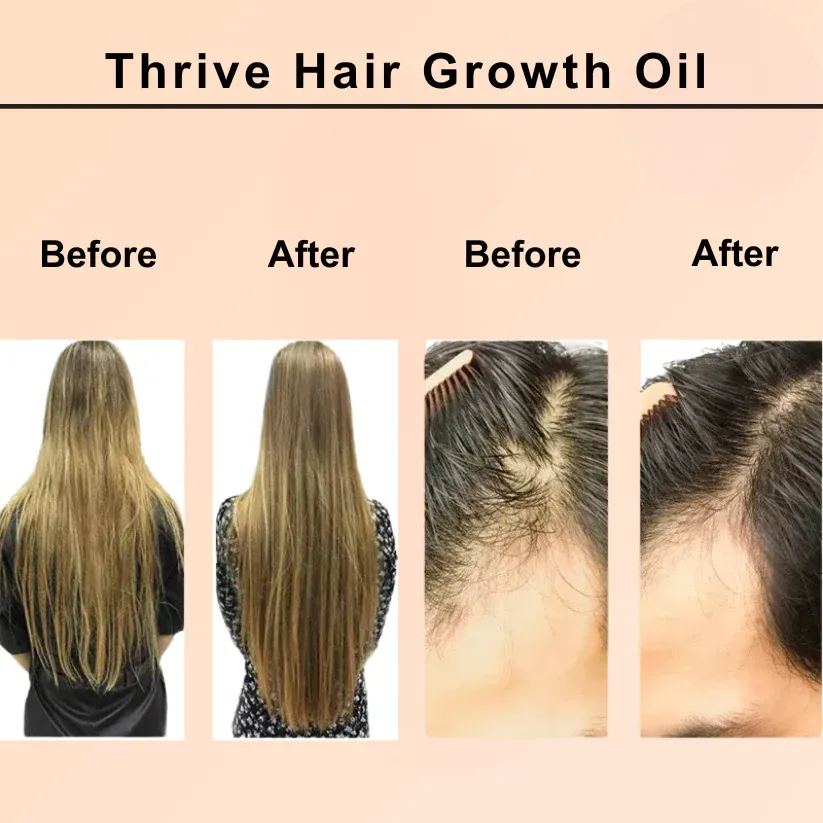 Purc™ Natural Hair Growth Oil