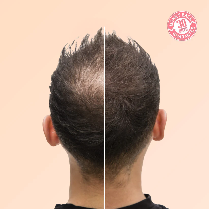 Purc™ Natural Hair Growth Oil