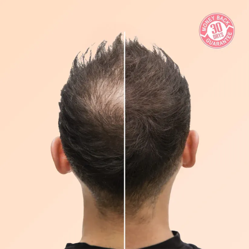 Purc™ Natural Hair Growth Oil