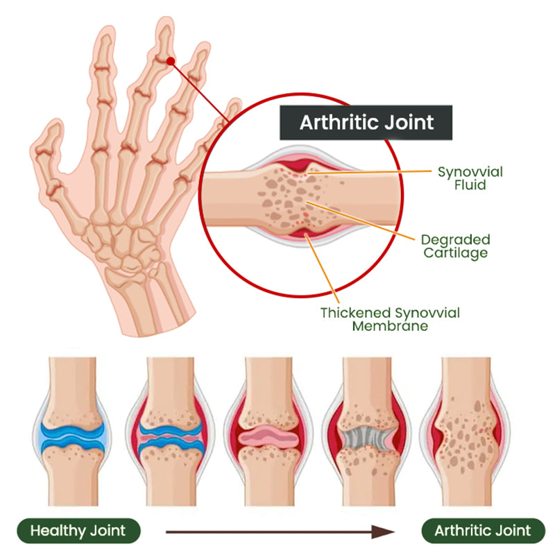 Adfire® Bee Venom Bone & Joint Revive Spray