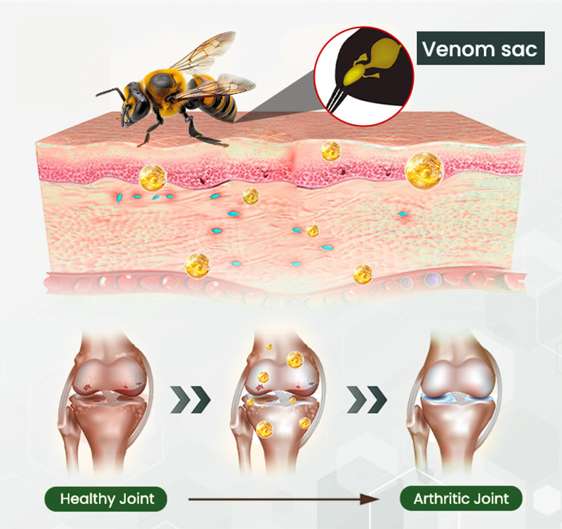 Adfire® Bee Venom Bone & Joint Revive Spray