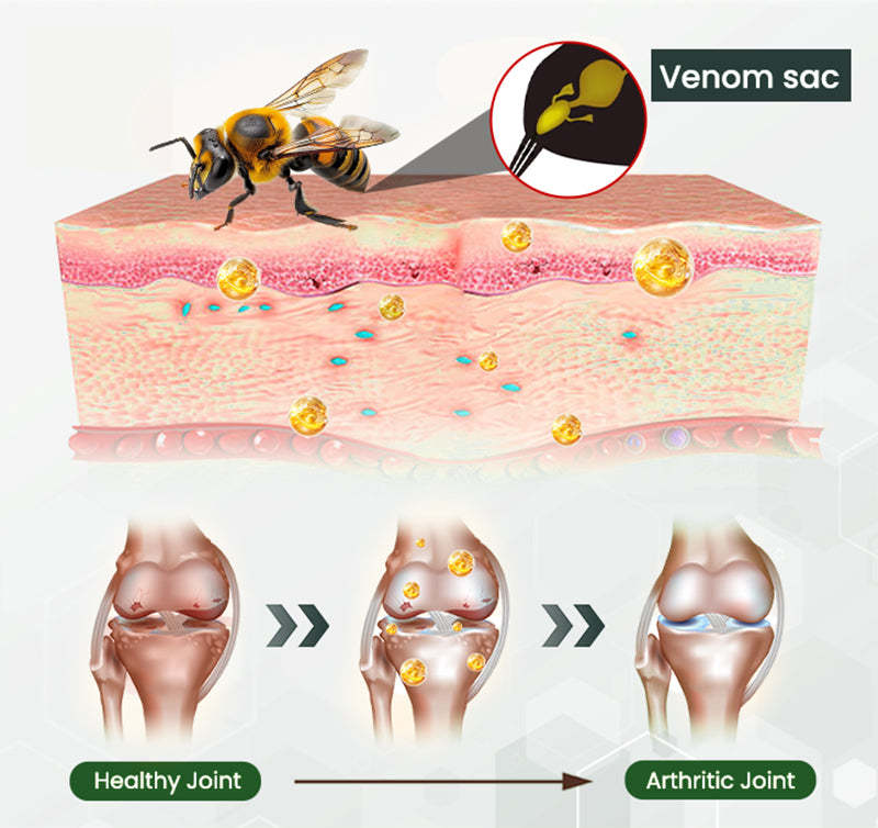 Adfire® Bee Venom Bone & Joint Revive Spray