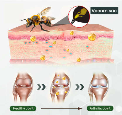 Adfire® Bee Venom Bone & Joint Revive Spray