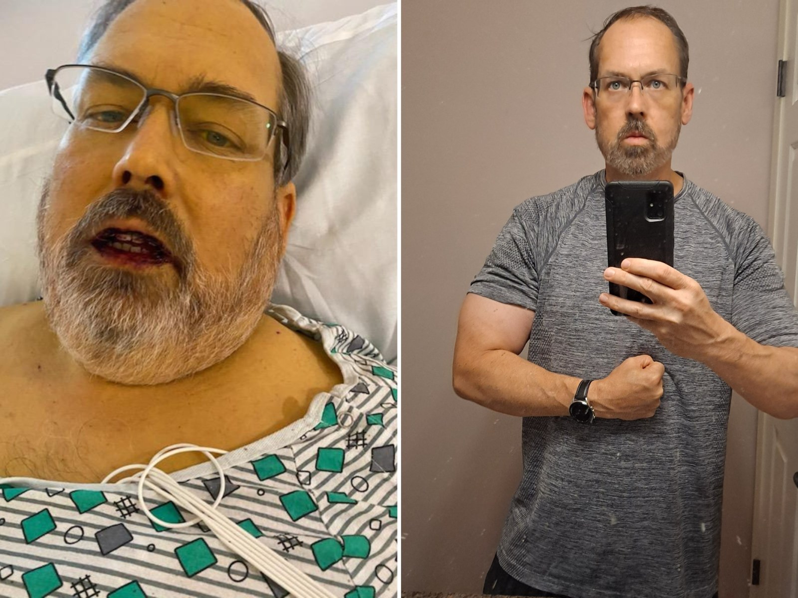 AnnieCare® Natural Herbal Liver Supplement