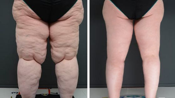 AnnieCare® Natural Herbal Liver Supplement