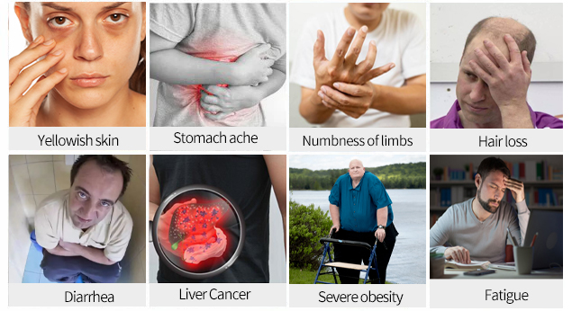 AnnieCare® Natural Herbal Liver Supplement