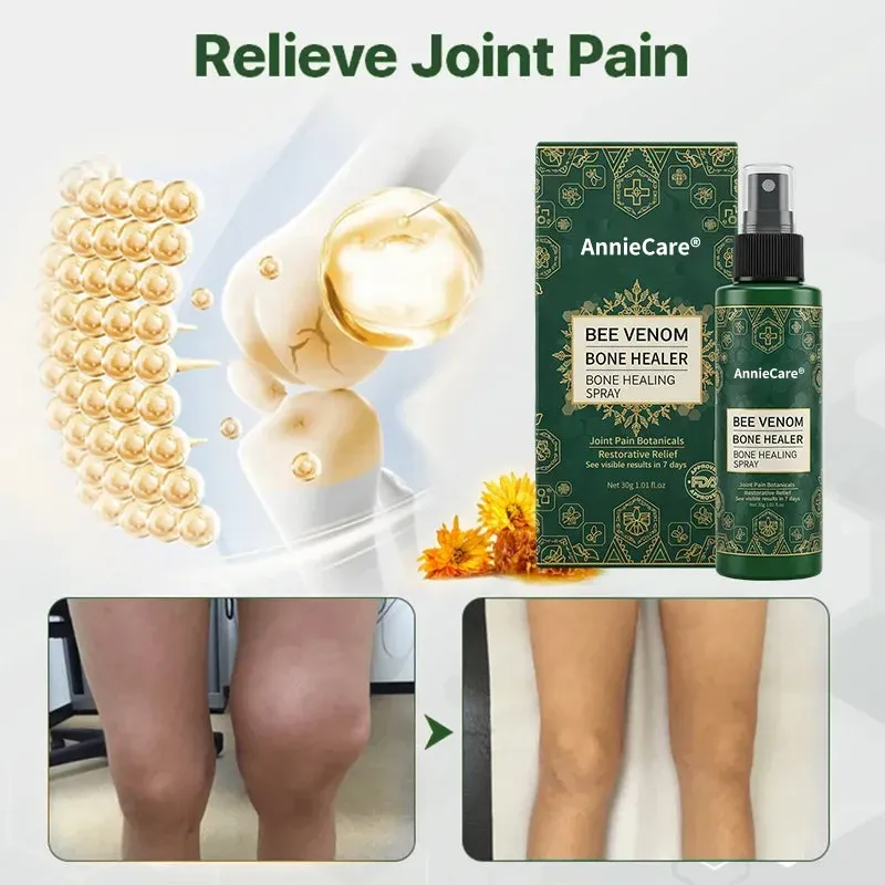 AnnieCare® Bee Venom Bone & Joint Revive Spray