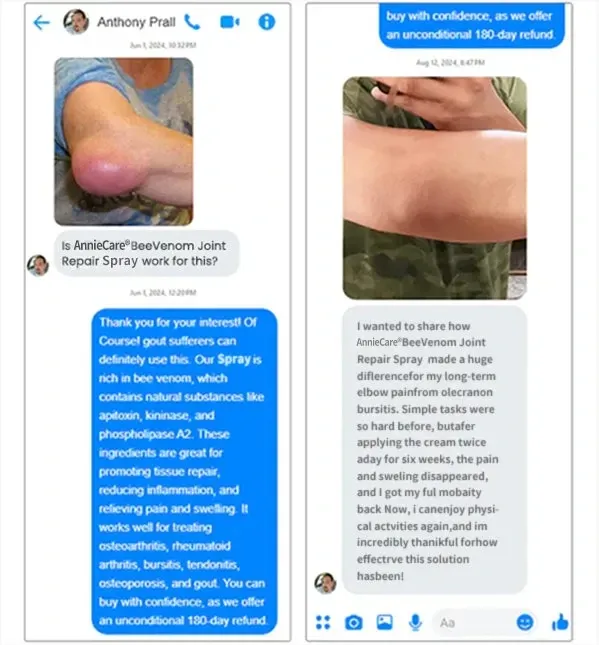 AnnieCare® Bee Venom Bone & Joint Revive Spray