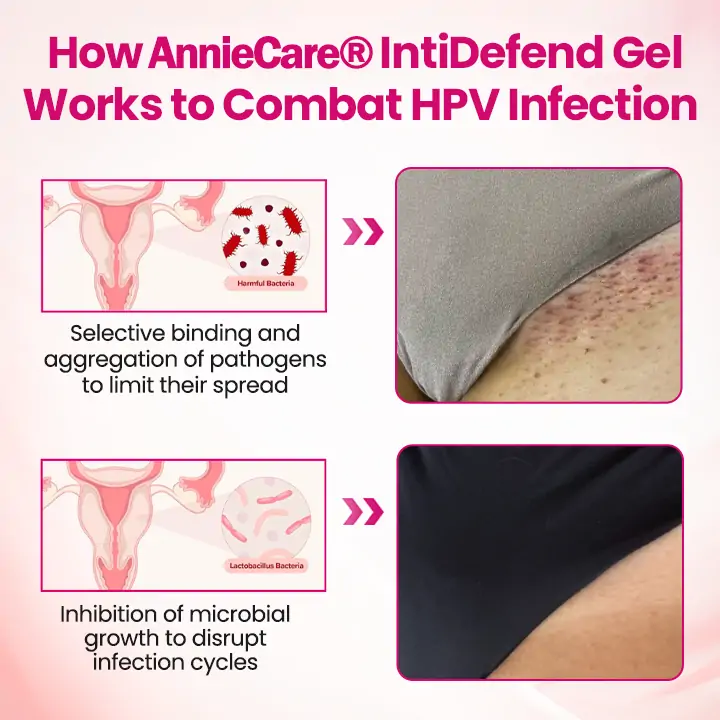 AnnieCare® IntiDefend Anti-HPV Interferon Gel