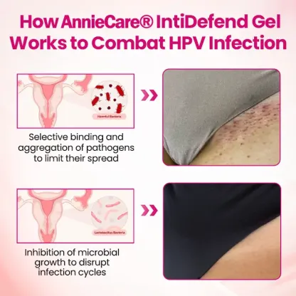 AnnieCare® IntiDefend Anti-HPV Interferon Gel