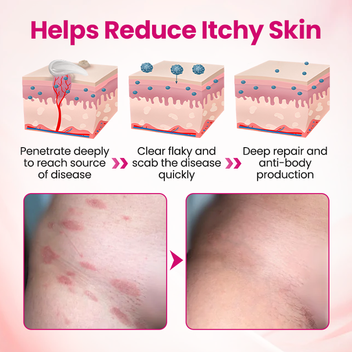 AnnieCare® IntiDefend Anti-HPV Interferon Gel