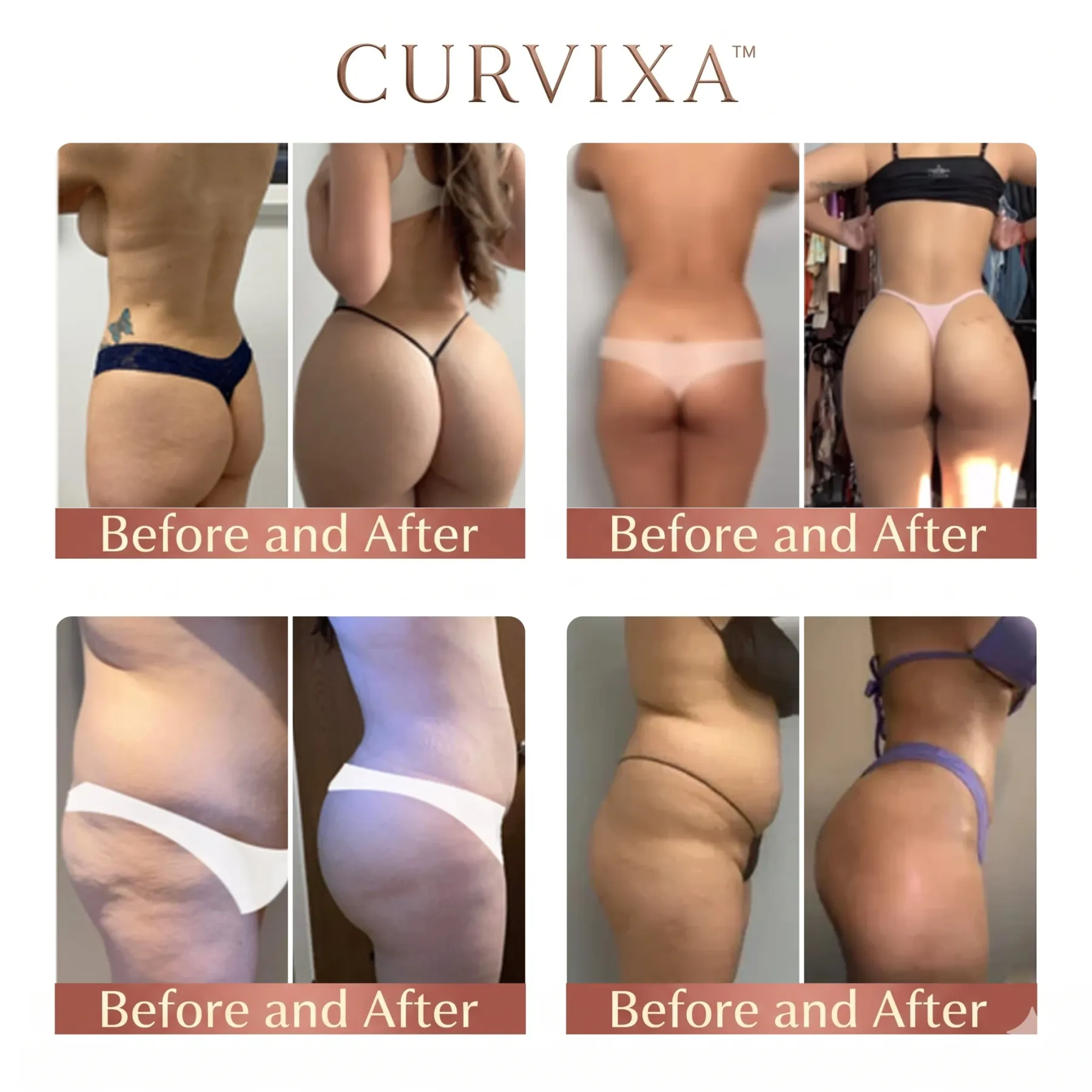Curvixa™ PRO CurveSculpt Micro-Patch ✦ Sculpt • Firm • Smooth Lower Body Curves ✦ Micro-Needle Infusion System