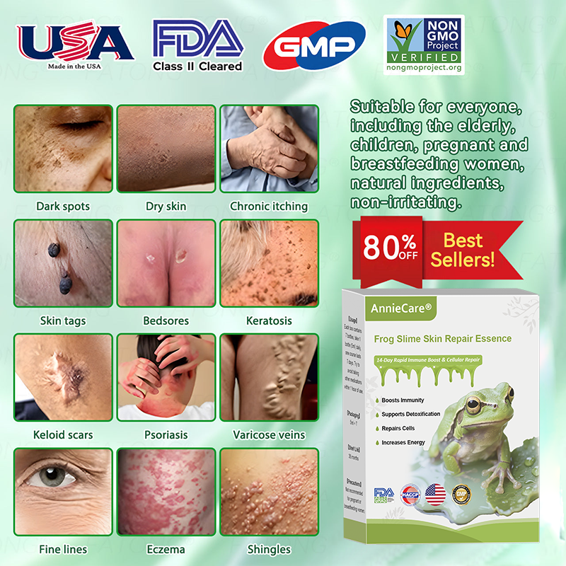 Anniecare® Frog Slime Skin Repair Essence🐸