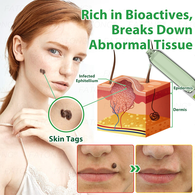 Anniecare® Frog Slime Skin Repair Essence🐸