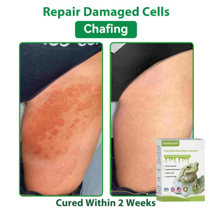 Anniecare® Frog Slime Skin Repair Essence🐸