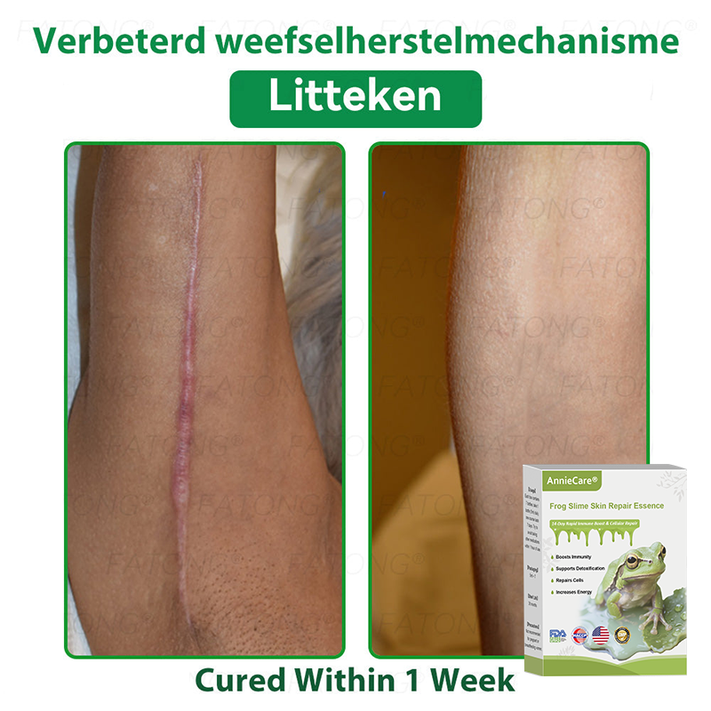 Anniecare® Frog Slime Skin Repair Essence🐸