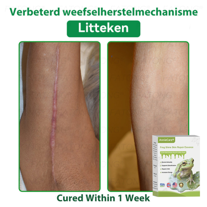 Anniecare® Frog Slime Skin Repair Essence🐸