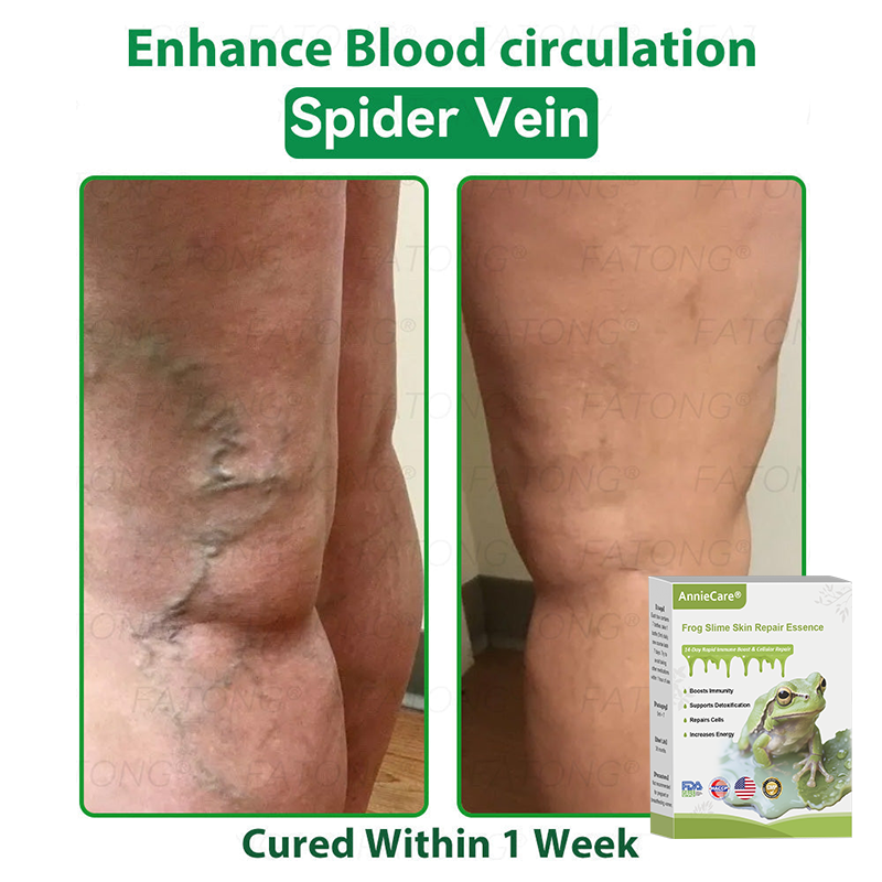 Anniecare® Frog Slime Skin Repair Essence🐸