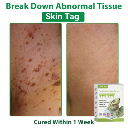 Anniecare® Frog Slime Skin Repair Essence🐸