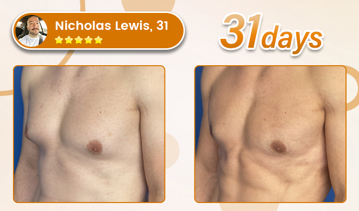 Bulkrion® Venom Define Bee Venom Gynecomastia Oil