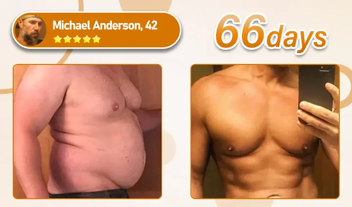 Bulkrion® Venom Define Bee Venom Gynecomastia Oil