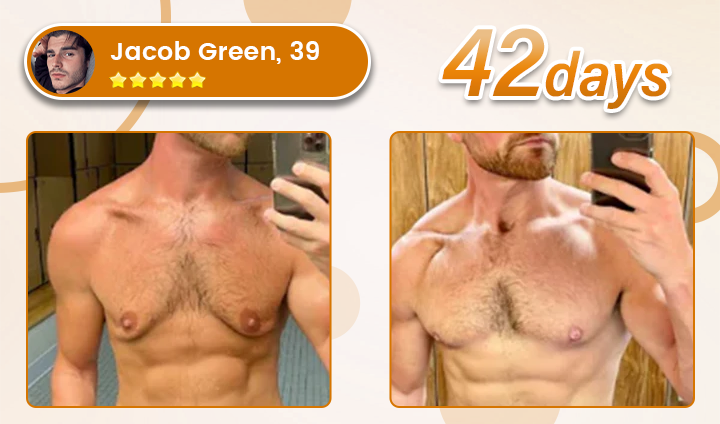 Bulkrion® Venom Define Bee Venom Gynecomastia Oil