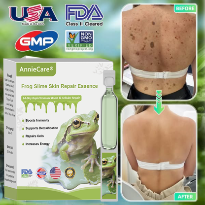 Anniecare® 𝐹𝑟𝑜𝑔 𝑀𝑢𝑐𝑢𝑠 𝑆𝑘𝑖𝑛 𝑅𝑒𝑝𝑎𝑖𝑟 𝑆𝑝𝑟𝑎𝑦 🐸