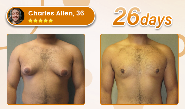 Bulkrion® Venom Define Bee Venom Gynecomastia Oil