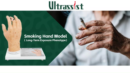 Ultrassist Smoker's Hand Model for Anti-Smoking Education