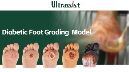 Ultrassist Diabetic Foot Ulcer Care Model Set, Grades 1–5