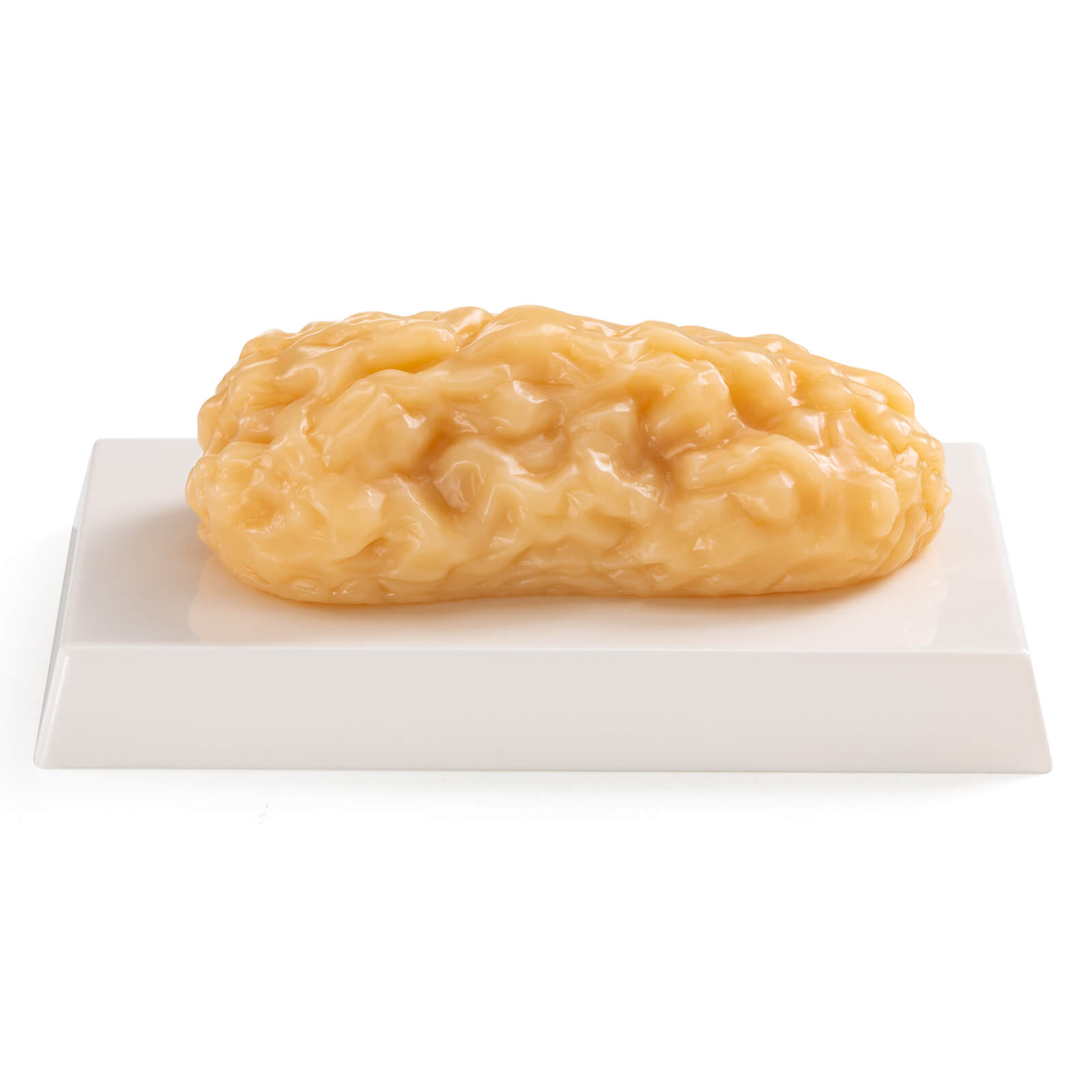 Ultrassist Human Body Fat Model (1, 2.5 & 5 lb) – Lifelike Fat Replicas for Fitness Training