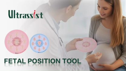 Midwife Fetal Position Tool - Cephalic & Breech