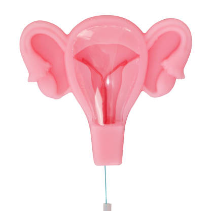 3D Uterus IUD Placement Training Model