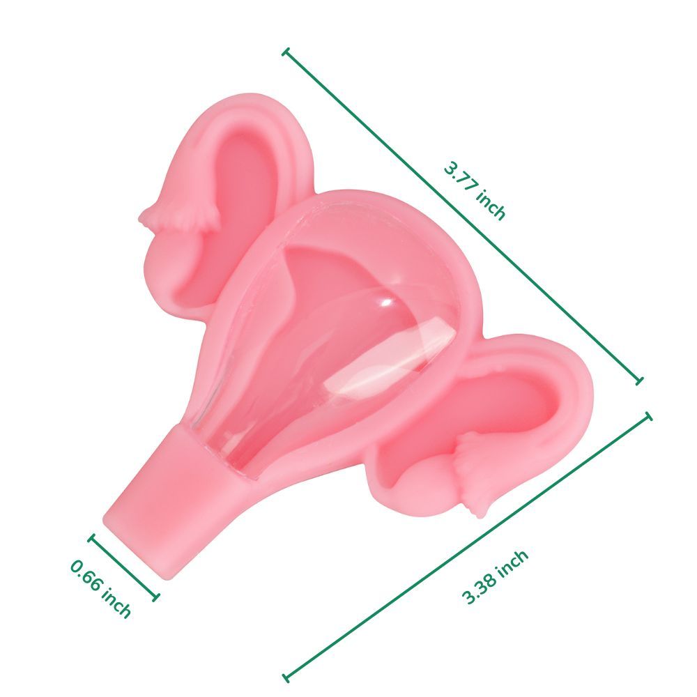 3D Uterus IUD Placement Training Model