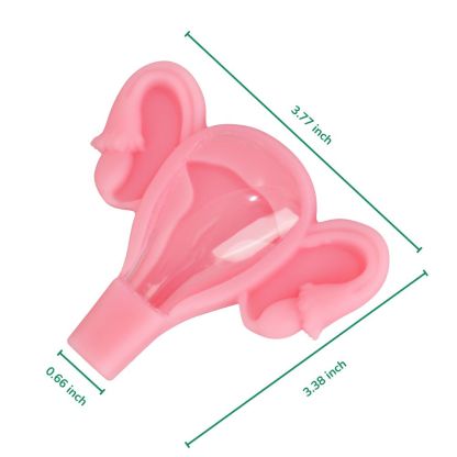 3D Uterus IUD Placement Training Model