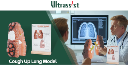 Ultrassist Cough Up Lung Model for Smoking Education and Lung Anatomy