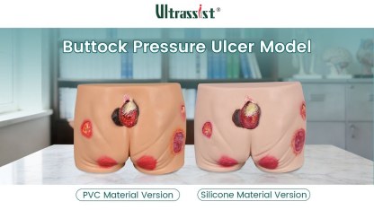 Decubitus Ulcer Buttocks Simulator (Silicone)