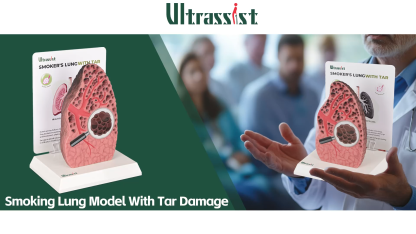 Ultrassist Cross-Sectional Smoking Lung Model – Realistic Tar Damage for Smoking Education