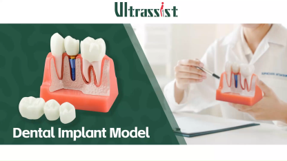 4X Dental Implant Model with Crown & Bridge - Pink