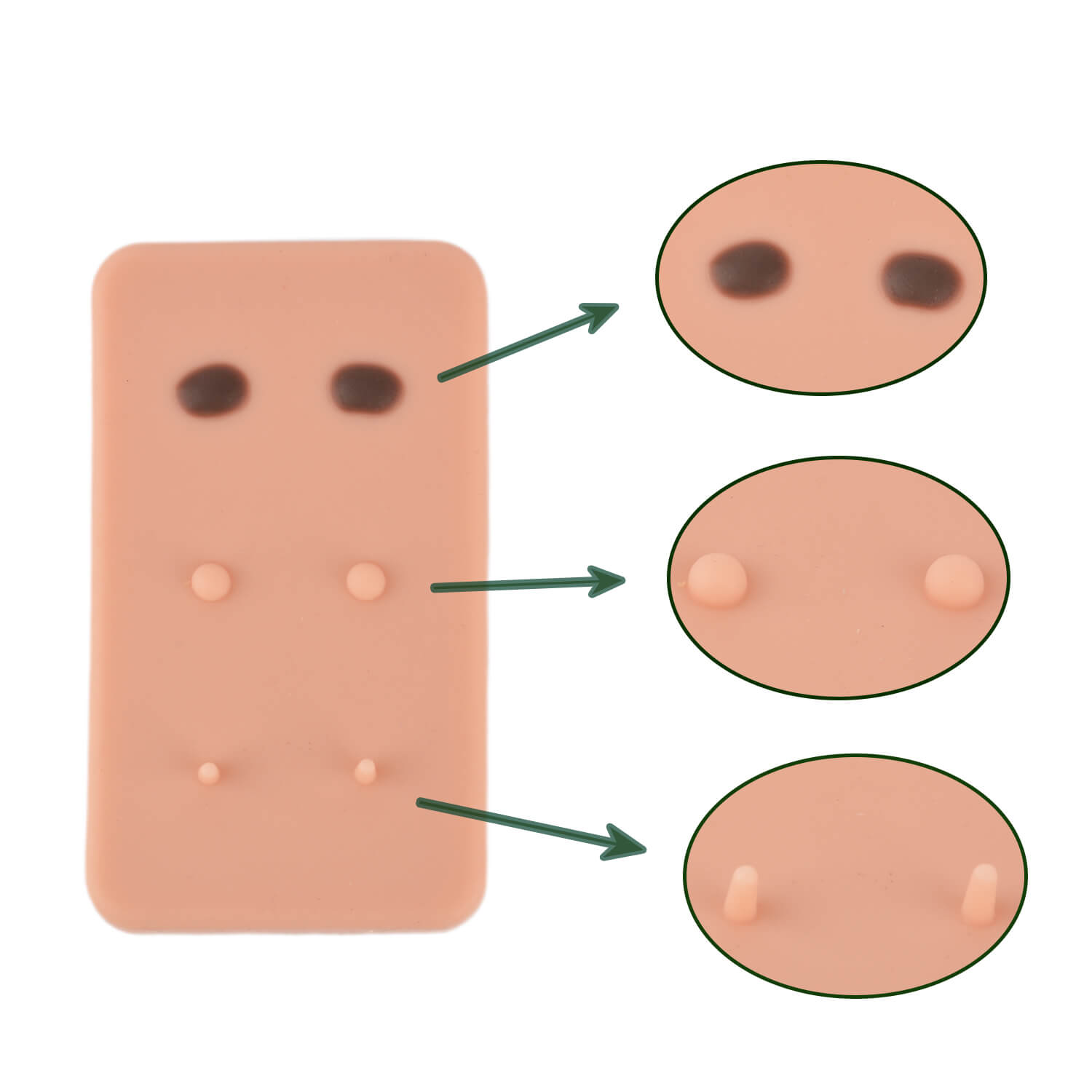 Silicone skin lesion removal practice model for dermatology training